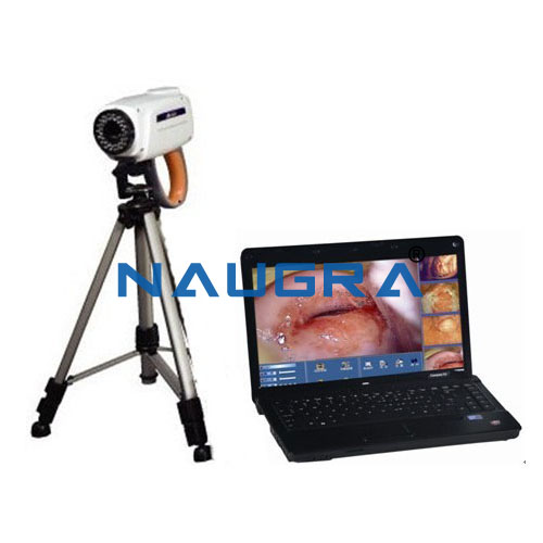 Laptop Video Colposcope