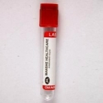 Serum Test Tubes (MOQ: 100,000 Pcs Assorted Size)