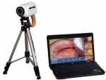 Laptop Video Colposcope